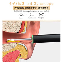 Load image into Gallery viewer, BEBIRD X17 Pro Ear Wax Removal Tool 1080p Camera Endoscope