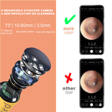 Load image into Gallery viewer, BEBIRD D3 Pro Smart Ear Wax Removal Otoscope Giraffe-Shaped